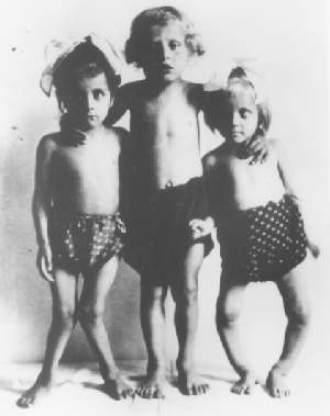 Children with rickets